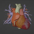 1.png 3D Model of Heart (from real patient)