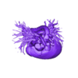 STL.stl 3D Model of Human Heart with Tetrology of Fallot (TOF) - generated from real patient