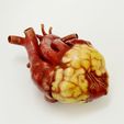 IMG_9325.jpg Anatomical model of obese heart