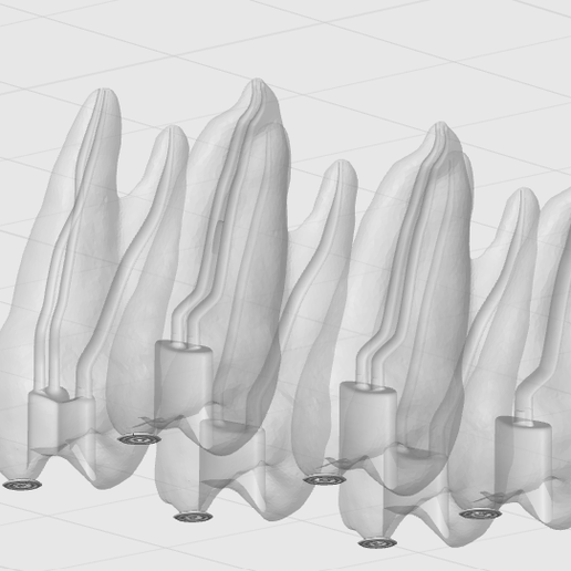 Maxillary 1st & 2nd Premolars (Complex Anatomies) – Endo Training | 4 STL Models