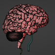 29.png 3D Model of Brain and Aneurysm