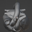 14.png 3D Heart Anatomy with Codominance