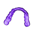 789513050_20240808_0848_Tech_01_K_bruxi_2.stl DIGITAL BRUXISM TRAY/SPLINT - 3 stl files (tray+model+antagonist)