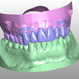 modelo.png Complete dental model