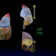 lung-pulmonary-segment-anatomy-3d-model-blend-23.jpg Lung Pulmonary segment anatomy 3D model