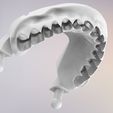 14.jpg 3D Dental Jaws Replica with Detachable Teeth