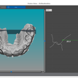 Q ®#o S ® Cn Pees ool Qr easily 33.3 ed Unit: mam SUPERIOR MAXILLARY from Intraoral Scan - AREA3D- Patient A. TOP DENTURE