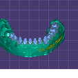 Безымянный.png 3d model of the lower jaw for 3d printer(3д модель нижней челюсти для 3д принтера )