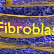 file-6.jpg Caseating granuolma tuberculosis labelled 3D model