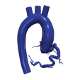 1.png 3D Model of Aorta and Coronary Arteries - 6pack