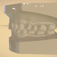 Screenshot_31.png Digital Orthodontic Study Models with Virtual Bases