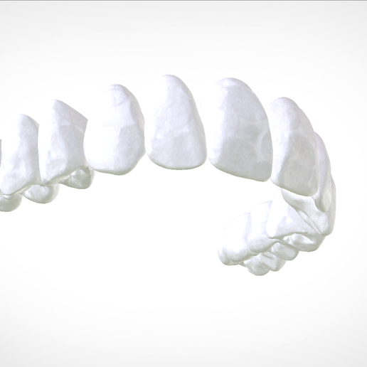 Screenshot_12.png Download OBJ file Digital Full Dentures for Gluedin Teeth with Manual Reduction • 3D printable design, LabMagic3DCAD