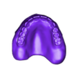789513050_20250505_0858_Tech_01_OM3_H_total_a_D_Flex_0_Monoblock.stl TOTAL REMOVABLE DENTURE upper + FLEXI PARTIAL DENTURE lower ( total 11 stl files)
