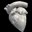 4.png 3D Model of Heart (apical 4 chamber plane)