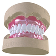 4.png Digital Full Dentures with Combined Glue-in Teeth Arch