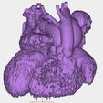 7.jpg 先天性心脏病分类（CHD）