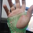 Imagen-de-WhatsApp-2025-03-20-a-las-12.28.28_79a4c579.jpg 3D printable cast for wrist splint
