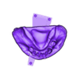 789513050_20241126_1405_Tech_01__A3_HaD_flex_UnsectionedModel_LowerJaw.stl DIGITAL FLEXIBLE PARTIAL DENTURES upper + lower (3D models !!!) - 12 stl files for download