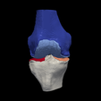 3.png 3D Model of Knee - generated from a real patient
