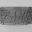 p1.png Full size Lower and upper teeth, occlusion
