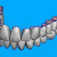 01.jpg Teeth for temporary crowns - maxillary+mandibular-teeth