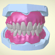 Screenshot_15.png Full Dentures with Many Production Options