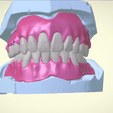 Screenshot_17.png Full Dentures with Many Production Options
