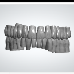 Vertices: 331517 Facets: 662922 3shape> atte | @Ee ‘SF en 18q STL file ANG tooth library・3D printing model to download