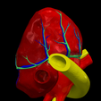 5.png 3D Model of Common Arterial Trunk Truncus Arteriosus