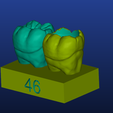 Screenshot_1.png Restorative model of the 46th tooth for dental students