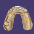 OCLUSAL-SUP.png ENCERADO / MOCK-UP #2
