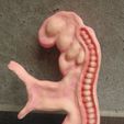 26-dias-4.jpg human embryo, 26 days