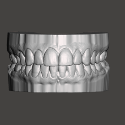 1.png Dental model, mouth, teeth