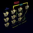 pelvis-fracture-classifications-3d-model-blend-21.jpg Pelvis fracture classifications 3D model