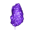OBJ1-polycystic kidney.obj 3D Model of Polycystic Kidney
