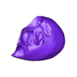 STL00005.stl 3D Model of Human Heart with Tetrology of Fallot (TOF) - generated from real patient