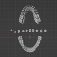 1.png Dental models with removable dies