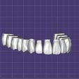 Dentes-Maxila-Alternative-Exocad.jpg Teeth Upper Jaw - Exocad - Alternative