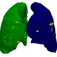1.png 3D Model of Lungs Infected with Covid19