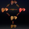 ps15.jpg 3D Alchoholic liver disease cirrhosis hepatitis fatty model