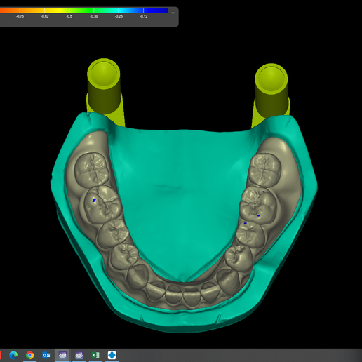 Captura-de-pantalla-51.png UPPER & LOWER TEETH