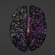 37.png 3D Model of Brain and Aneurysm
