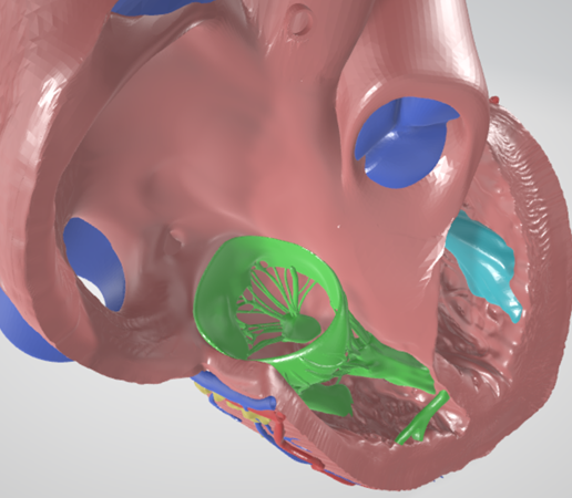 heart,-cardiac,-left,-right,-atrium,-ventricle,-coronary,-artery,-vein,-vena-cava,-aorta,-pulmonary,.png Ultra Realistic High-Resolution 3D Normal Heart Model with Aorta, Pulmonary Artery & Vein, Coronary Artery & Vein, Pulmonary & Aortic Valves, Mitral Valve, and Tricuspid Valve