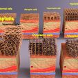 2.jpg adaptation epithelial cell changes normal to cancer Low-poly 3D model