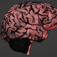 12.png 3D Model of Brain - section