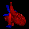 4.png 3D Model of Heart after Fontan Procedure