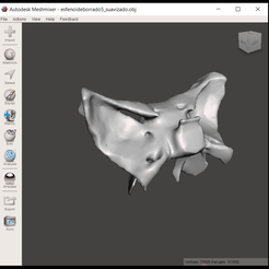 esfenoide.png sphenoid bone - sphenoid bone