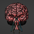 31.png 3D Model of Brain and Aneurysm
