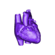 heart with tof1.obj 3D Model of Heart with Tetralogy of Fallot (ToF)