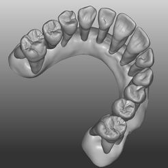 imagen modelo sup.jpg Dental morphology "UpperJaw"